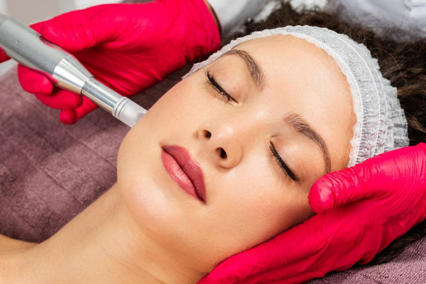 Microneedling Behandlung